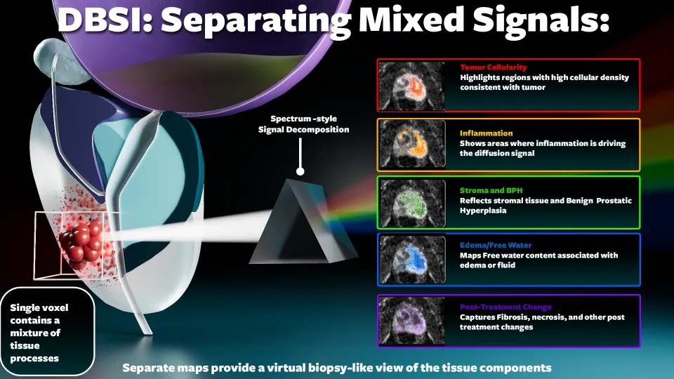 Diagram showing DBSI acting like a prism to separate a mixed prostate diffusion signal into distinct tissue component signatures including restricted, hindered, and free diffusion fractions